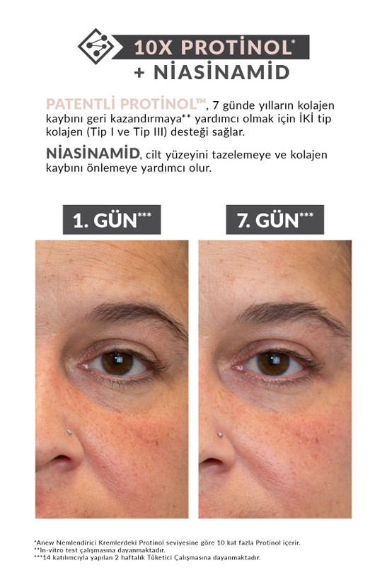 کرم ضدچروک بازسازی کننده پوست پروتینول پاور و نیاسینامید آنیو Avon